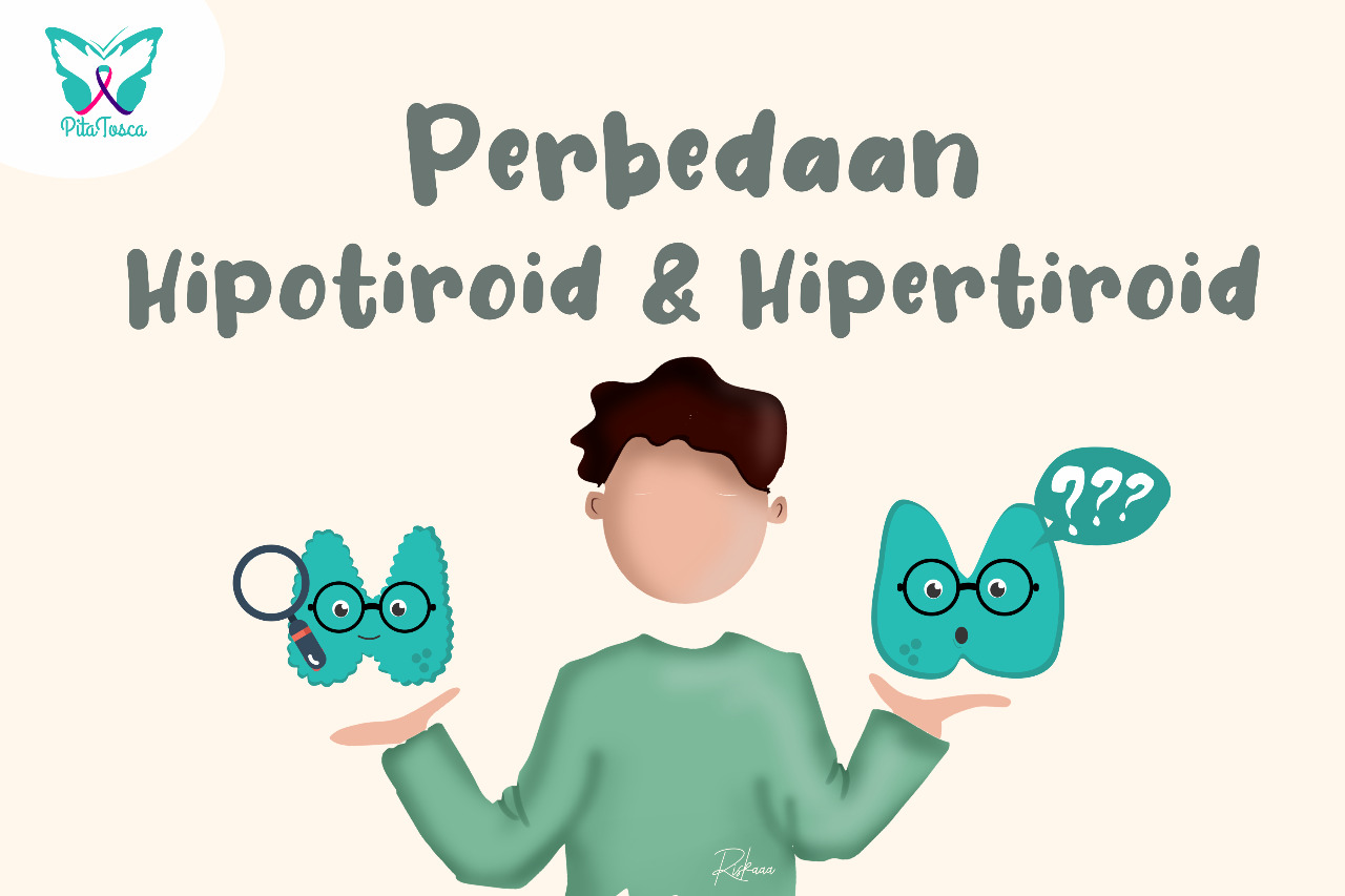 Apa sih Perbedaan Hipertiroid dan Hipotiroid ?