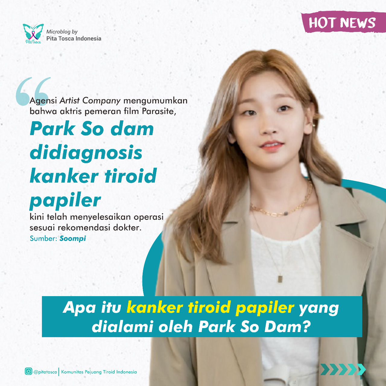 Apa itu kanker tiroid papiler yang dialami oleh Park So Dam?